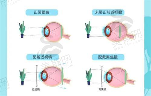 乌鲁木齐美尼康眼科医院医生介绍
