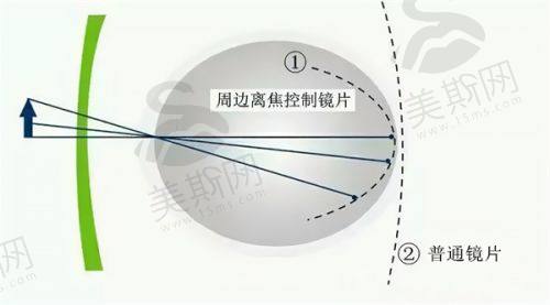 乌鲁木齐美尼康眼科医院口碑如何