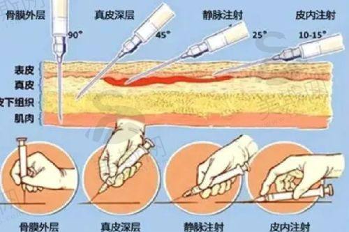 术后指南