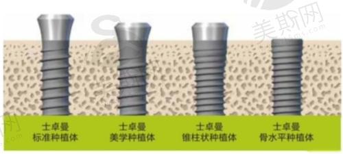 深圳格伦菲尔口腔门诊部口碑怎么样