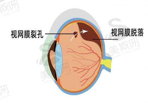 北京希玛林顺潮眼科医院是正规医院，它是私立医院吗？口碑咋样？收费贵不贵？