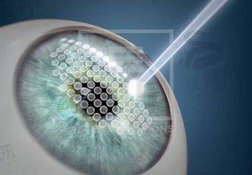 北京希玛林顺潮眼科医院是连锁眼科品牌