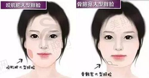 医生推荐 & 手术流程