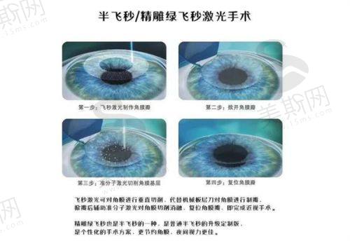 深圳深西爱尔眼科医院地址及电话