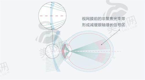 深圳深西爱尔眼科医院较好的眼科设备