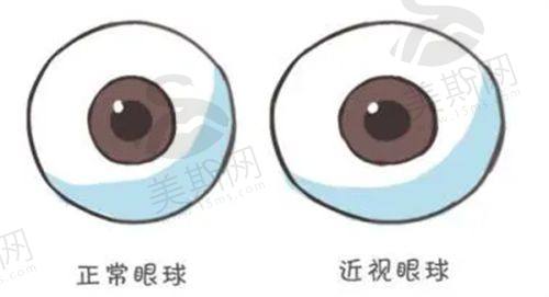 兰大二院眼科骨干医生