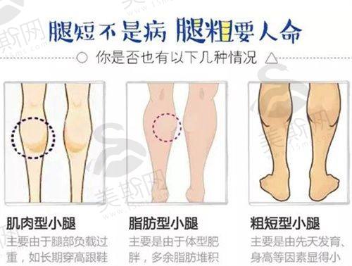 总结