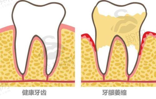 慈溪茂洁口腔