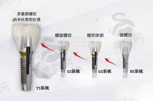 牙齿矫正优势