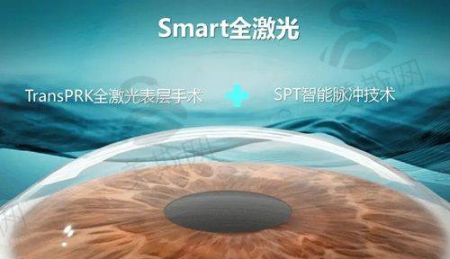 沈阳爱尔眼科近视手术隐藏费用清单