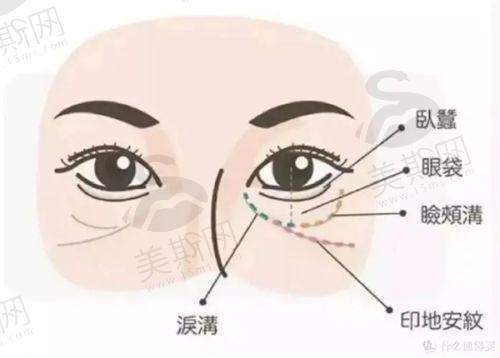 西安艺星医疗美容医院的知乎评价如何?