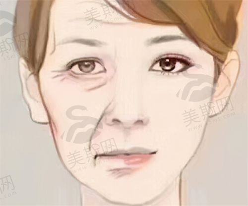 韩国Gold J皮肤科医院正规吗?
