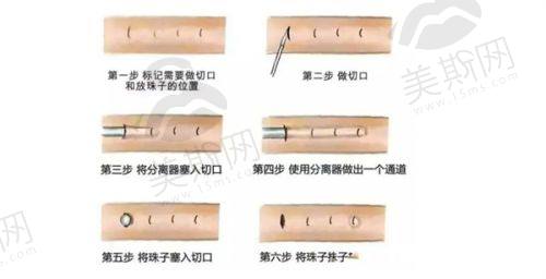 韩国俪伴整形外科 (Liban Clinic)正规吗？