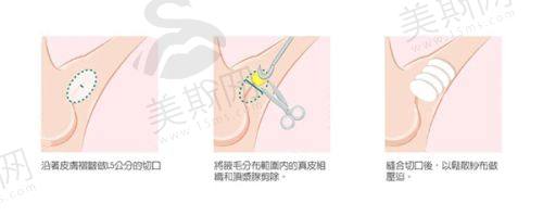 韩国Gold J皮肤科医院地址电话