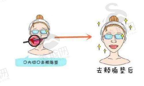 韩国Gold J皮肤科医院怎么样?