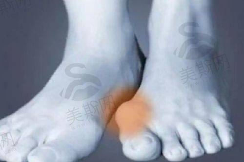 总结