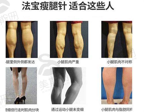赵善军 医生预约挂号