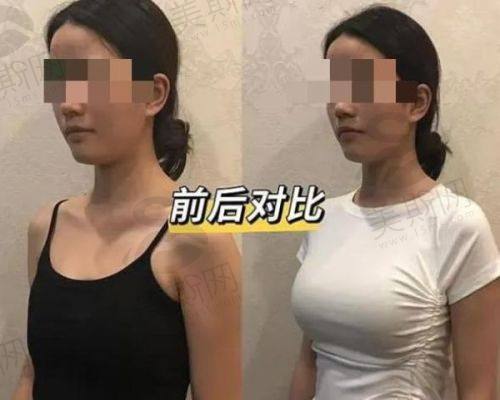实例2：先天发育不足女孩的美丽逆袭