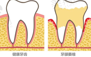 金铂利口腔医院种植牙怎么样