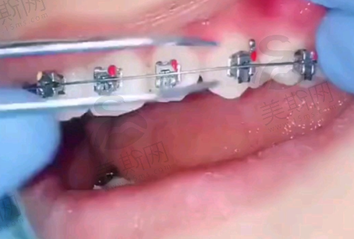 湛江德澳口腔