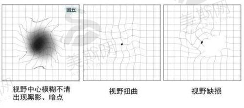 北京爱尔眼科收费价目表 2025