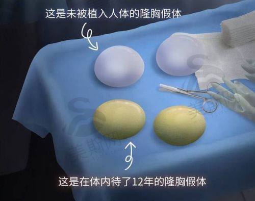 6. 舒美精量麻醉2.0：全程清醒，轻松手术