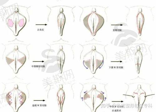 三、太原私密紧缩术哪里医院做的好收费情况