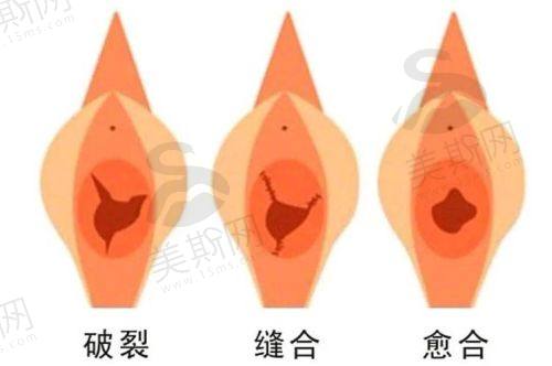 8、太原私密紧缩术排名第八：太原华晋医院医疗美容科
