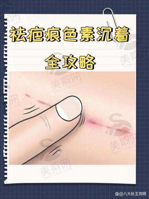 总结