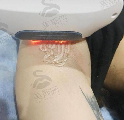 10、太原银黛医疗美容诊所——太原激光脱毛哪里更好之小众精品诊所