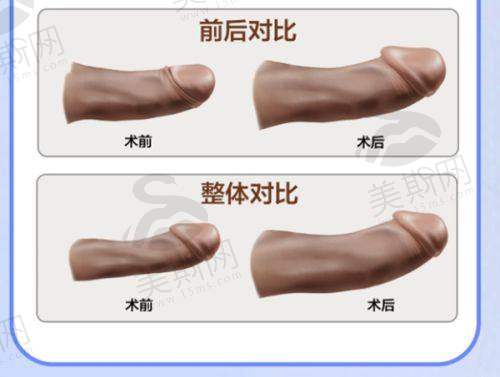 总结