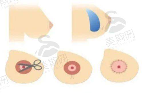 韩国BLS皮肤科医院正规吗？