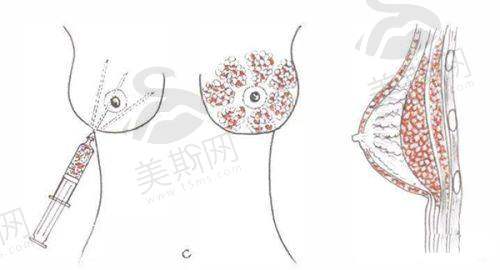 北京八大处牙齿正畸