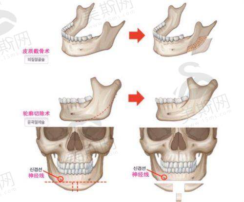 西双版纳地区整形项目价目表2025参考