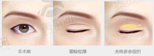王旭明医生微博动态