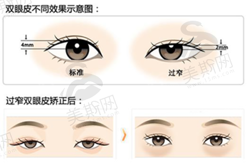 皮肤美容项目