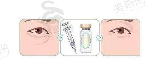 浙江台州薇阁医疗美容