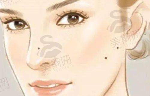 刘远程和李建刚谁更好?术后5年数据:下垂率与满意度实证