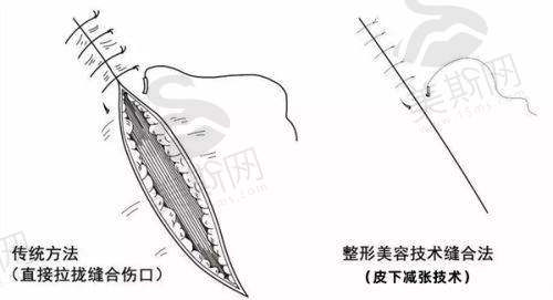 江苏南京施尔美整形医院
