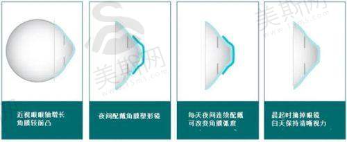 南宁、百色、桂林免费白内障手术定点医院介绍