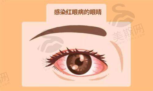 九江爱尔眼科咨询免费咨询，含医生、电话、地址信息，揭秘医院性质与营业时间