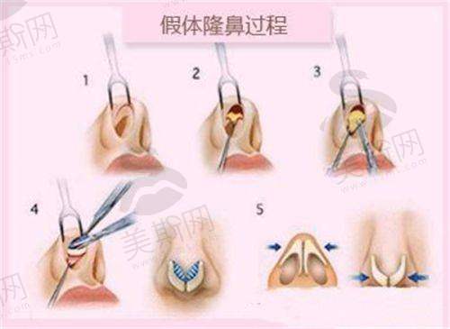 韩国baid皮肤科医院口碑如何