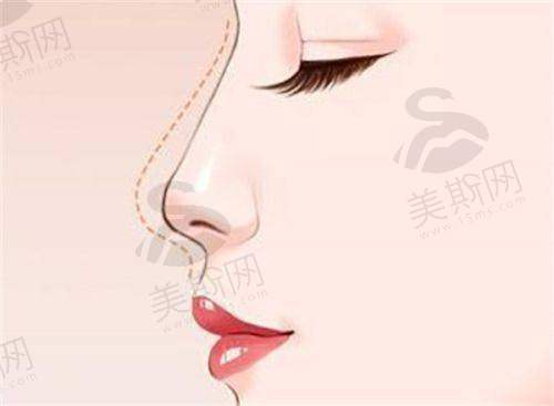 私立整形医院资讯