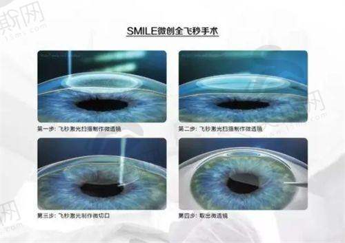 九江爱尔眼科询问服务有何特色