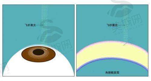 临沂市人民医院眼科——不断完善设备的进步之院