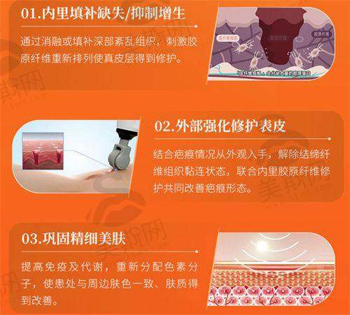杭州艺星做眼综合怎么样