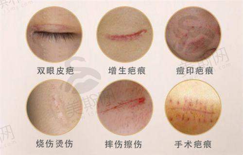 北京八大处鼻部整形价格