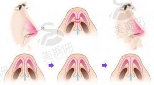 总结