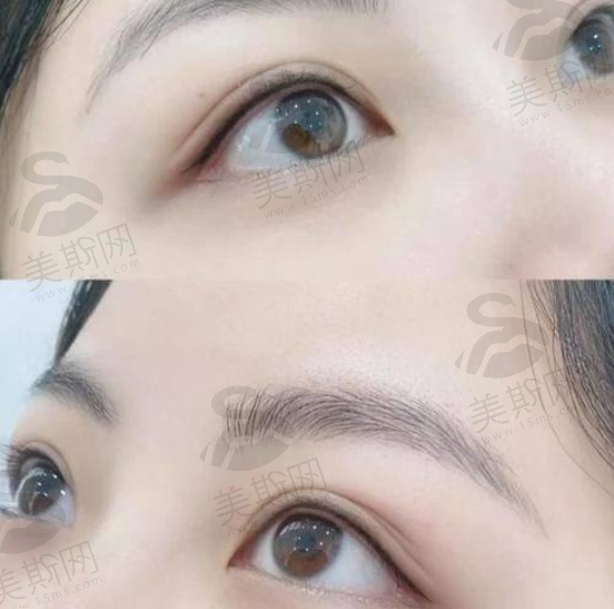 钻石超塑的成效