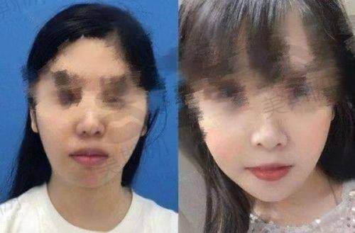 长春娅秘珠医疗美医院口碑如何